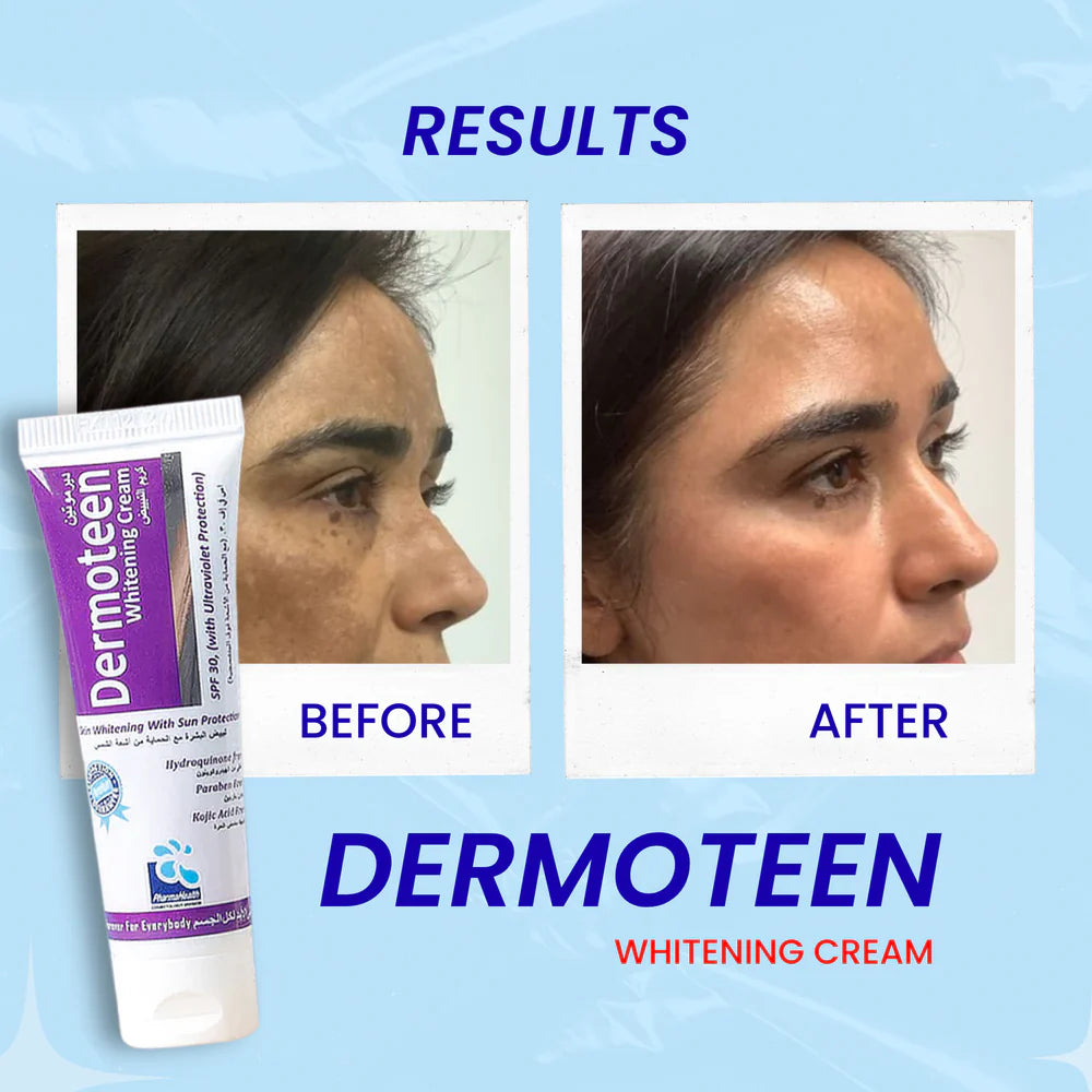 Pharma Health Dermoteen Whitening Cream, 20ml