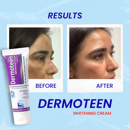 Pharma Health Dermoteen Whitening Cream, 20ml